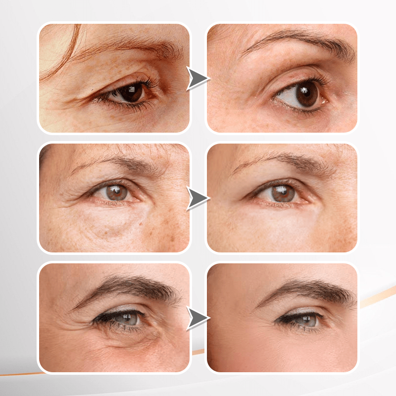(🔥LAST DAY SALE-80% OFF) LOVILDS™ YouthfulLift Firming Eye Cream