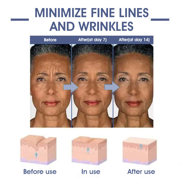 𝐋𝐚𝐬𝐭 𝐃𝐚𝐲 𝐃𝐢𝐬𝐜𝐨𝐮𝐧𝐭: 87% 𝐎𝐅𝐅🌸LOVILDS® 𝐀𝐝𝐯𝐚𝐧𝐜𝐞𝐝 𝐅𝐢𝐫𝐦𝐢𝐧𝐠 & 𝐖𝐫𝐢𝐧𝐤𝐥𝐞-𝐑𝐞𝐝𝐮𝐜𝐢𝐧𝐠 𝐂𝐫𝐞𝐚𝐦: Restore Skin Elasticity