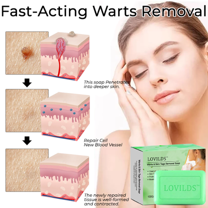 LOVILDS™ Warts & Skin Tags Removal Soap✨(⏳ FINAL DAY! Buy 1 Get 1 FREE! ⏳)