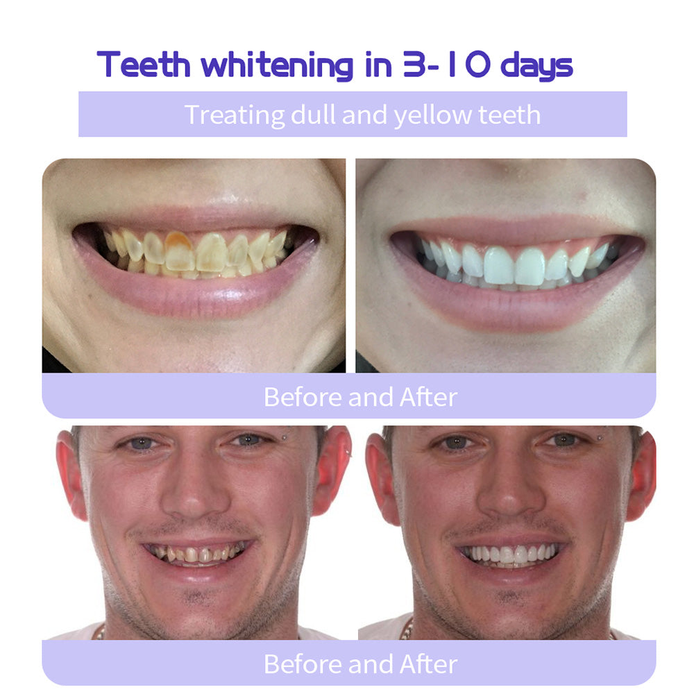 BBOJI™ Fluoride-Free Nano-Hydroxyapatite Toothpaste🦷(✨ADA recommended)(⏳ FINAL DAY! Buy 1 Get 1 FREE! ⏳)