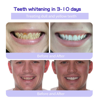 BBOJI™ Fluoride-Free Nano-Hydroxyapatite Toothpaste🦷(✨ADA recommended)(⏳ FINAL DAY! Buy 1 Get 1 FREE! ⏳)
