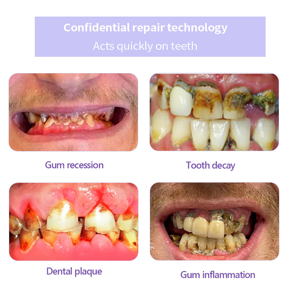 BBOJI™ Fluoride-Free Nano-Hydroxyapatite Toothpaste🦷(✨ADA recommended)(⏳ FINAL DAY! Buy 1 Get 1 FREE! ⏳)