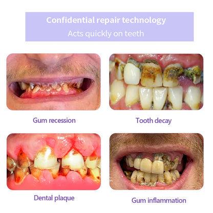 BBOJI™ Fluoride-Free Nano-Hydroxyapatite Toothpaste🦷(✨ADA recommended)(⏳ FINAL DAY! Buy 1 Get 1 FREE! ⏳)