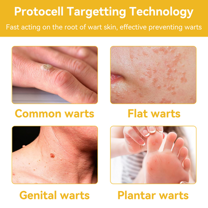 LOVILDS™ TagRecede Bee Venom Wart Treatment Spray -⚠️ Last 4 Days: 40% Off!⏰