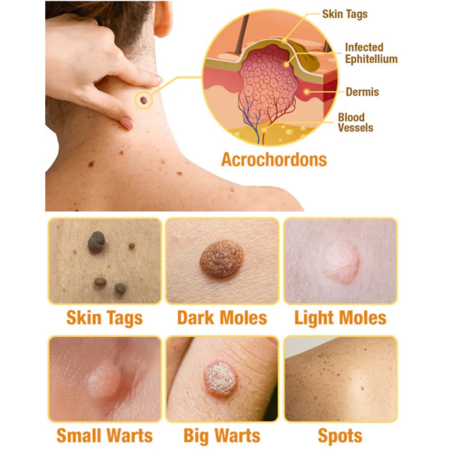 LOVILDS™ TagRecede Bee Venom Wart Treatment Spray -⚠️ Last 4 Days: 40% Off!⏰