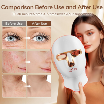 🔥 Last 3 Hours Discount: 60% OFF 🌸Medazy 4D Laser Light Therapy Mask