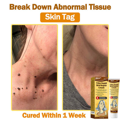BBOJI™ 𝟕-𝐃𝐚𝐲 𝐑𝐚𝐩𝐢𝐝 𝐒𝐤𝐢𝐧 𝐑𝐞𝐩𝐚𝐢𝐫 𝐂𝐫𝐞𝐚𝐦 𝐔𝐒 𝐃𝐞𝐫𝐦𝐚𝐭𝐨𝐥𝐨𝐠𝐢𝐬𝐭 𝐀𝐩𝐩𝐫𝐨𝐯𝐞𝐝(💞💞𝐀𝐀𝐃 𝐑𝐄𝐂𝐎𝐌𝐌𝐄𝐍𝐃𝐒)