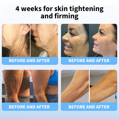 𝐋𝐚𝐬𝐭 𝐃𝐚𝐲 𝐃𝐢𝐬𝐜𝐨𝐮𝐧𝐭: 87% 𝐎𝐅𝐅🌸LOVILDS® 𝐀𝐝𝐯𝐚𝐧𝐜𝐞𝐝 𝐅𝐢𝐫𝐦𝐢𝐧𝐠 & 𝐖𝐫𝐢𝐧𝐤𝐥𝐞-𝐑𝐞𝐝𝐮𝐜𝐢𝐧𝐠 𝐂𝐫𝐞𝐚𝐦: Restore Skin Elasticity