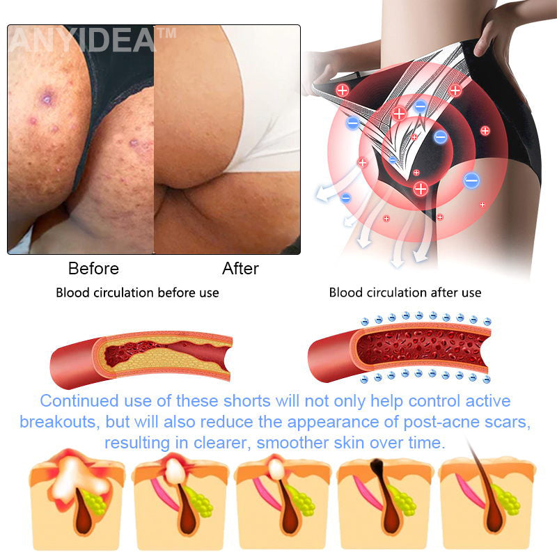 Titanium Fiber Self-heating Tourmaline Shaping Shorts💙Recommended by British Medical Association(BMA)