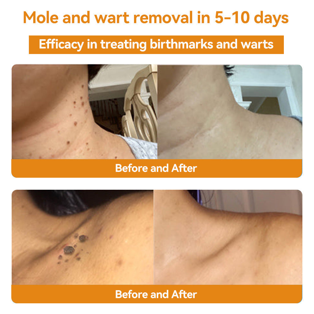 LOVILDS™ TagRecede Bee Venom Wart Treatment Spray -⚠️ Last 4 Days: 40% Off!⏰