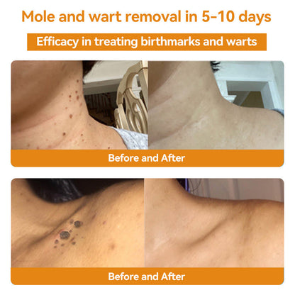 LOVILDS™ TagRecede Bee Venom Wart Treatment Spray -⚠️ Last 4 Days: 40% Off!⏰