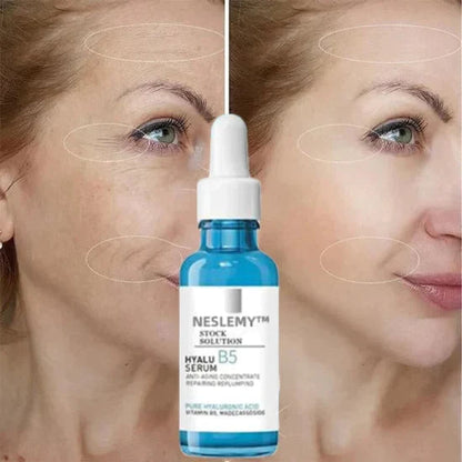 🎁Last Day Promotion 🎁-NESLEMY Clostridium botulinum Face Serum