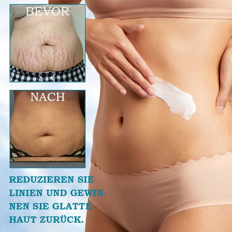 𝐋𝐚𝐬𝐭 𝐃𝐚𝐲 𝐃𝐢𝐬𝐜𝐨𝐮𝐧𝐭: 87% 𝐎𝐅𝐅🌸LOVILDS® 𝐀𝐝𝐯𝐚𝐧𝐜𝐞𝐝 𝐅𝐢𝐫𝐦𝐢𝐧𝐠 & 𝐖𝐫𝐢𝐧𝐤𝐥𝐞-𝐑𝐞𝐝𝐮𝐜𝐢𝐧𝐠 𝐂𝐫𝐞𝐚𝐦: Restore Skin Elasticity