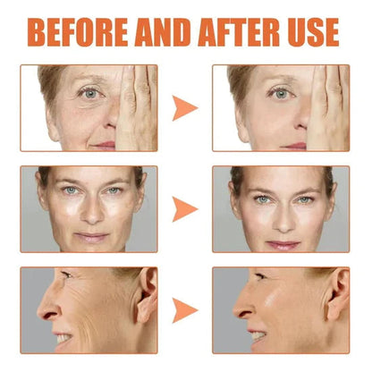 🎁Last Day Promotion 🎁-NESLEMY Clostridium botulinum Face Serum
