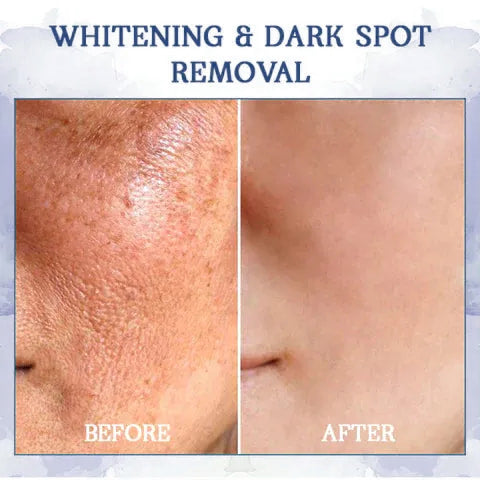 𝐋𝐚𝐬𝐭 𝐃𝐚𝐲 𝐃𝐢𝐬𝐜𝐨𝐮𝐧𝐭: 87% 𝐎𝐅𝐅🌸LOVILDS® 𝐀𝐝𝐯𝐚𝐧𝐜𝐞𝐝 𝐅𝐢𝐫𝐦𝐢𝐧𝐠 & 𝐖𝐫𝐢𝐧𝐤𝐥𝐞-𝐑𝐞𝐝𝐮𝐜𝐢𝐧𝐠 𝐂𝐫𝐞𝐚𝐦: Restore Skin Elasticity