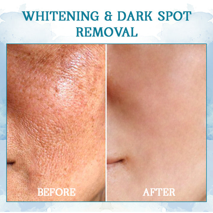 DIYSTAR™ LuxeLift Skin Firming Youth Butter🔥Best-Selling🔥
