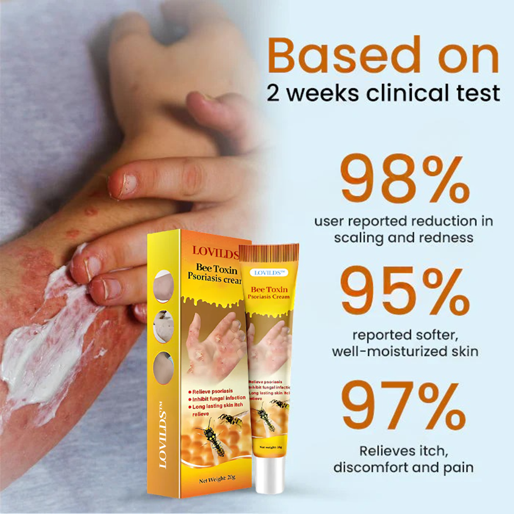 LOVILDS™ Bee Toxin  Psoriasis Cream