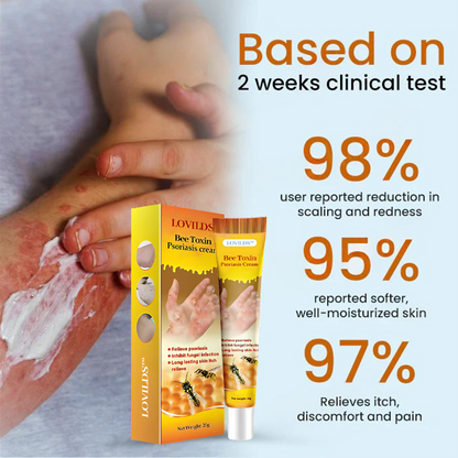 LOVILDS™ Bee Toxin  Psoriasis Cream