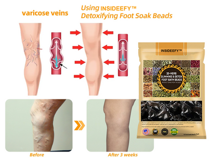 INSIDEEFY™ 30-Herb Slimming & Detox Foot Bath Beads-🦵👩‍⚕️(LANA Certification, Lymphatic Association of America)