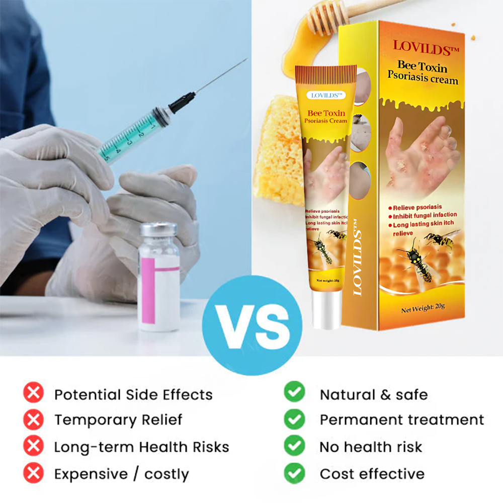 LOVILDS™ Bee Toxin  Psoriasis Cream