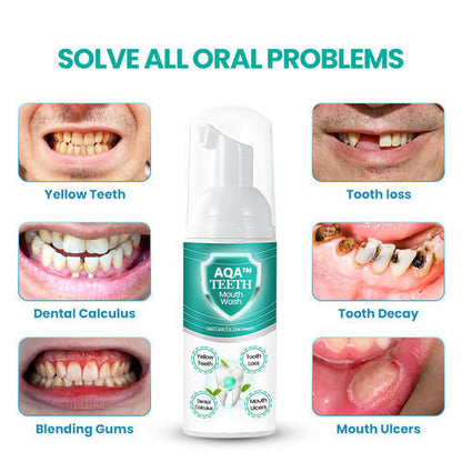 AQA™ NEW TEETH Mouthwash: End Bad Breath, Cavities & Gum Issues—Instantly!✨(⏳ FINAL DAY! Buy 1 Get 1 FREE! ⏳)