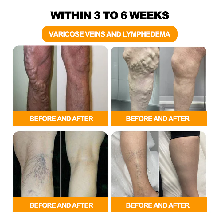 INSIDEEFY™ 30-Herb Slimming & Detox Foot Bath Beads-🦵👩‍⚕️(LANA Certification, Lymphatic Association of America)