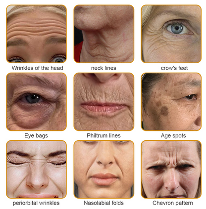 LOVILDS™ Botulin Bee Poison Wrinkle Removal Cream✨(⏳ FINAL DAY! Buy 1 Get 1 FREE! ⏳)