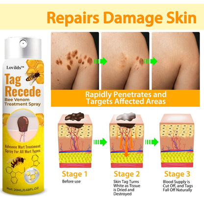 LOVILDS™ TagRecede Bee Venom Wart Treatment Spray -⚠️ Last 4 Days: 40% Off!⏰
