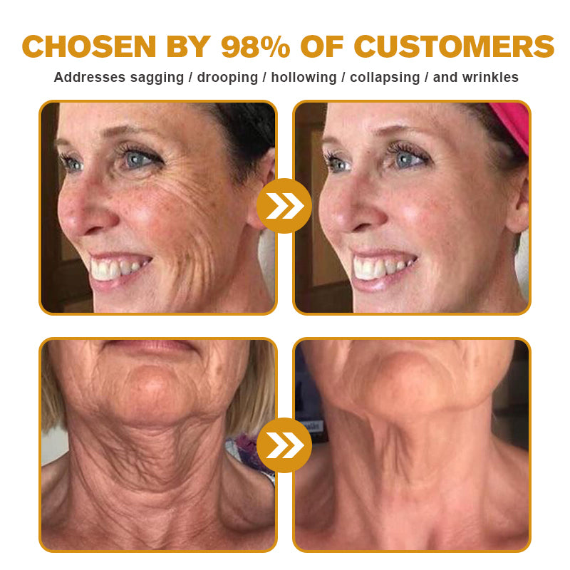 LOVILDS™ Botulin Bee Poison Wrinkle Removal Cream✨(⏳ FINAL DAY! Buy 1 Get 1 FREE! ⏳)