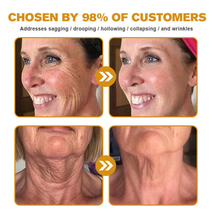 LOVILDS™ Botulin Bee Poison Wrinkle Removal Cream✨(⏳ FINAL DAY! Buy 1 Get 1 FREE! ⏳)