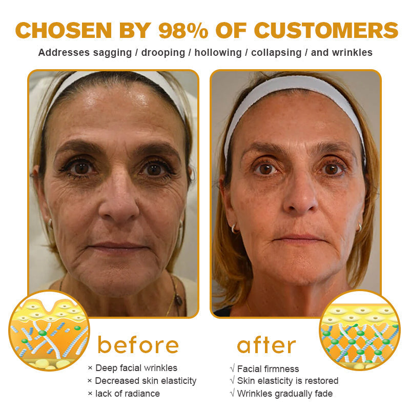 LOVILDS™ Botulin Bee Poison Wrinkle Removal Cream✨(⏳ FINAL DAY! Buy 1 Get 1 FREE! ⏳)