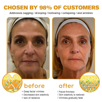 LOVILDS™ Botulin Bee Poison Wrinkle Removal Cream✨(⏳ FINAL DAY! Buy 1 Get 1 FREE! ⏳)