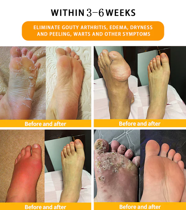 INSIDEEFY™ 30-Herb Slimming & Detox Foot Bath Beads-🦵👩‍⚕️(LANA Certification, Lymphatic Association of America)